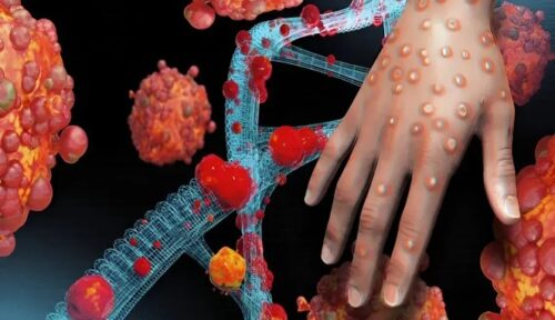 Lonjakan Kasus Cacar Monyet di Afrika Capai Angka Mencengangkan, 1.048 Orang Meninggal Dunia