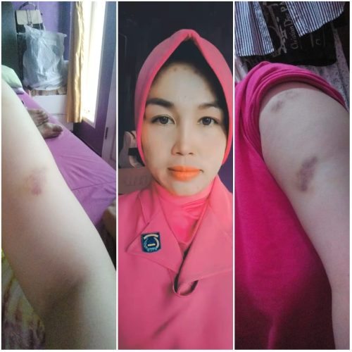 Dr. Klinik ini Dilaporkan Ernawati ke Polisi, Dugaan Penganiayaan