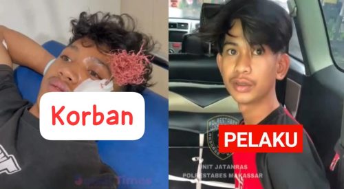 Teror Busur Panah di Makassar, Pemuda Luka Parah di Wajah, Pelaku Dicokok Polisi