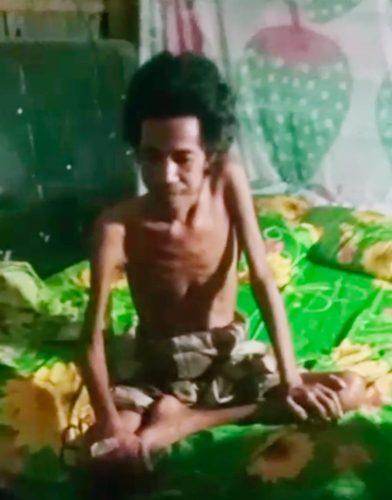 Miris! Warga Takalar ini Hidup Sakit, Lapar, dan Tak Tersentuh Bansos