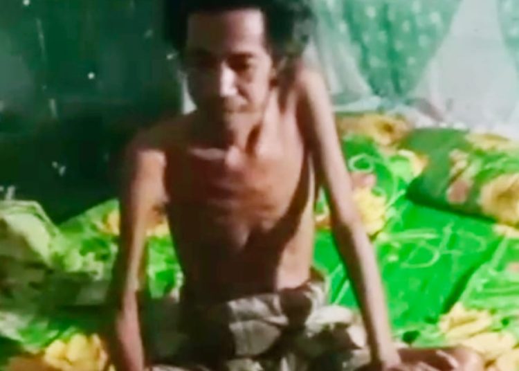 Miris! Daeng Nyengka di Takalar: Hidup Sakit, Lapar, dan Tak Tersentuh Bansos